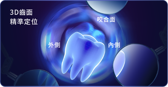 3D齒面 精準定位